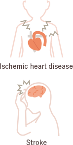 These are illustrations of the heart illustrating ischemic heart disease and illustrations of the head illustrating stroke.