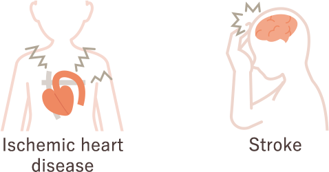 These are illustrations of the heart illustrating ischemic heart disease and illustrations of the head illustrating stroke.